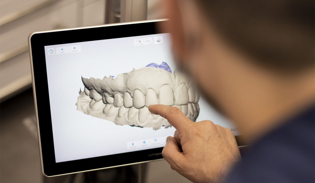 Software de Diseño Digital de Sonrisas